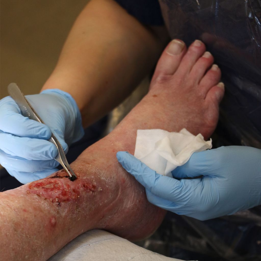 Doctor providing care for leg wound